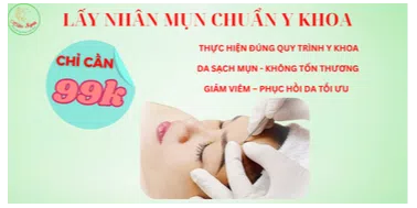 ảnh small 1
