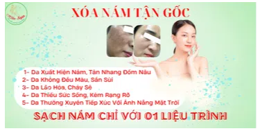 ảnh small 2