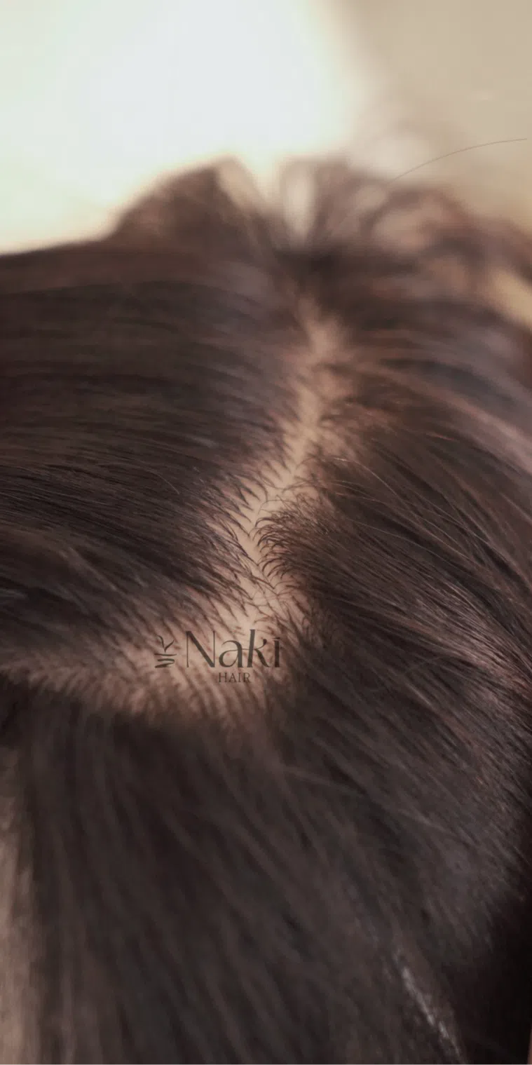 TOUPEE CHE PHỦ HÓI