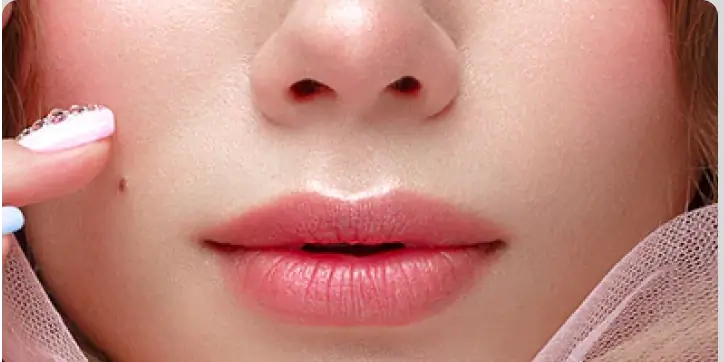 ảnh small 1